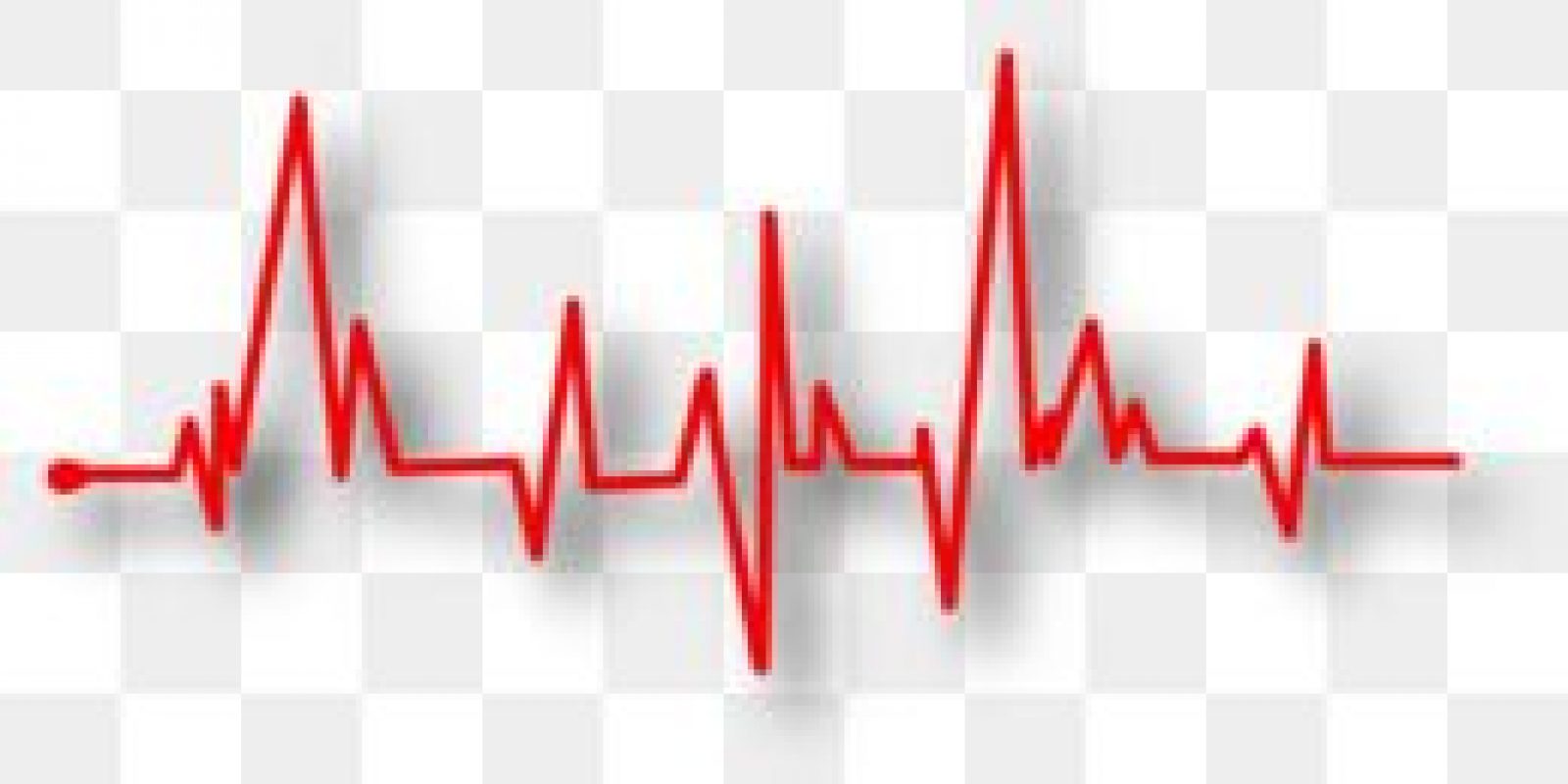 kisspng-heart-rate-pulse-electrocardiography-artery-medici-5b82dc7fee9919.0650417215353027839773
