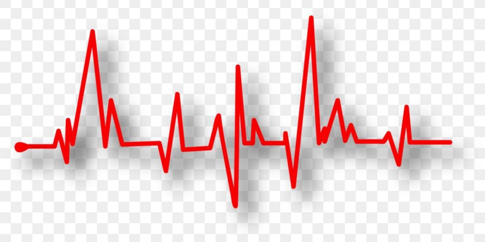 kisspng-heart-rate-pulse-electrocardiography-artery-medici-5b82dc8035b8e8.7297990415353027842201
